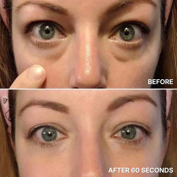 Perfecting Eye Tightener™